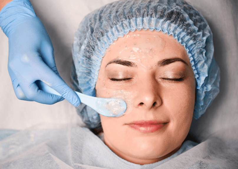 The Science of Rejuvenation with a Chemical Peel in Garden City