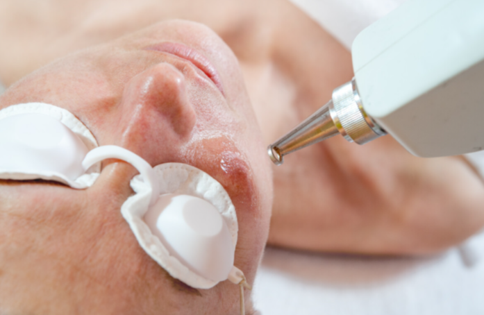 What Factors Influence the Cost of Skin Laser Treatments